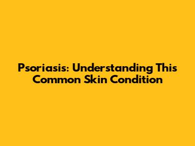 Psoriasis: Understanding This Common Skin Condition