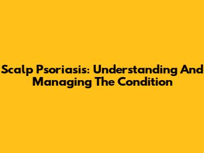 Scalp Psoriasis: Understanding And Managing The Condition
